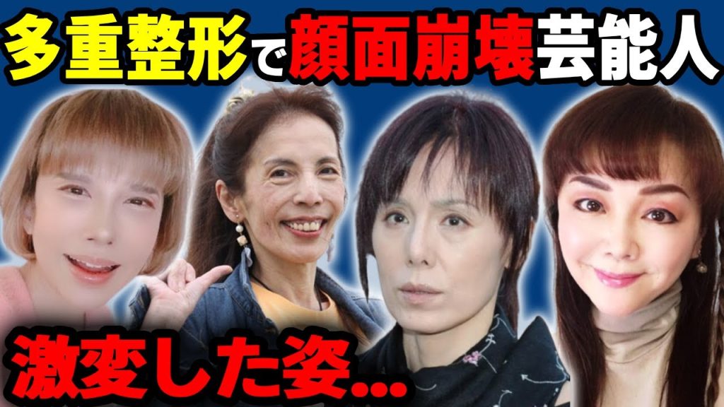 多重整形で顔面崩壊した芸能人達【激変した姿】