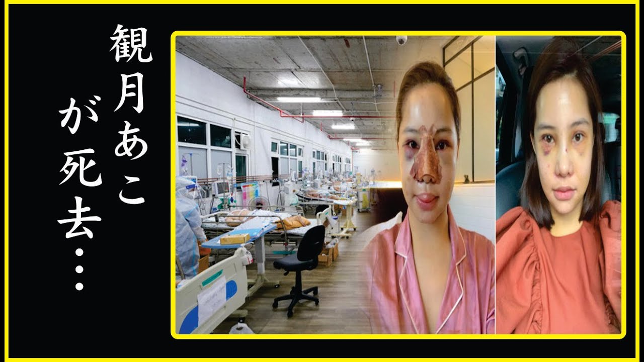 観月あこが緊急搬送された信じられない難病…激痩せで豹変した現在の生活に涙が溢れた！観月あこが"両足切断"と言われた現在の病状に涙が零れ落ちた…