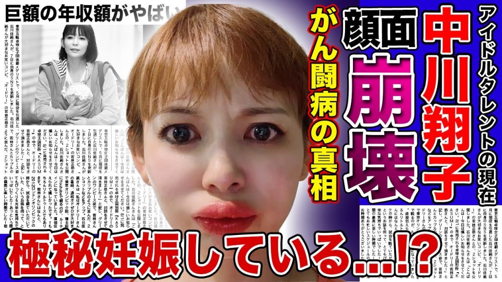 【衝撃】中川翔子が顔面崩壊した現在がやばい...！がん闘病を送ると言われる悲惨な現在...電撃結婚をした人気元アイドルが極秘妊娠をしている真相...現在の巨額の年収に驚きを隠せない！！