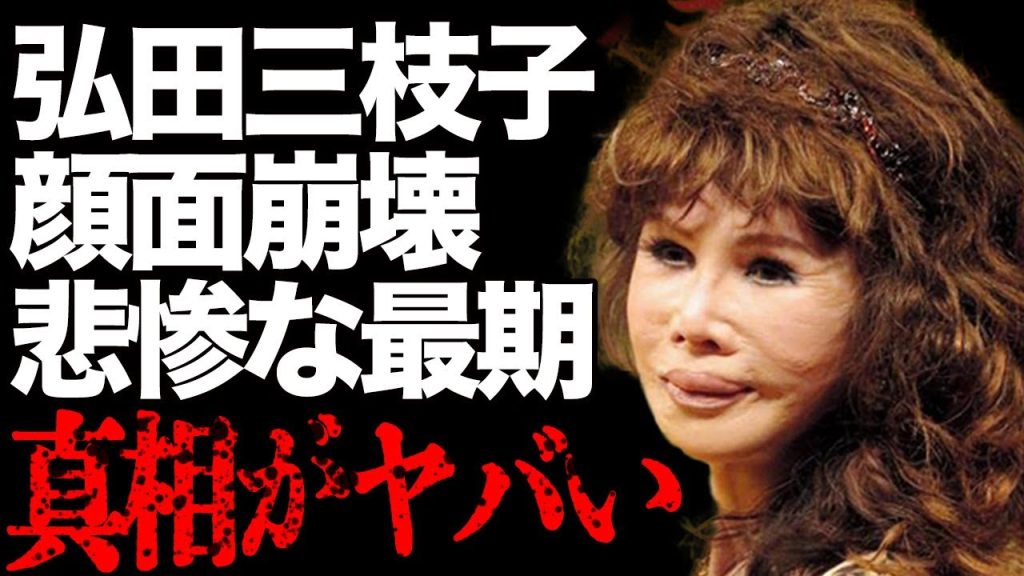 【衝撃】弘田三枝子の"顔面崩壊"や不倫で刺された"傷害事件"がヤバすぎる…『人形の家』で知られる歌手の悲惨な最期に驚きを隠せない…
