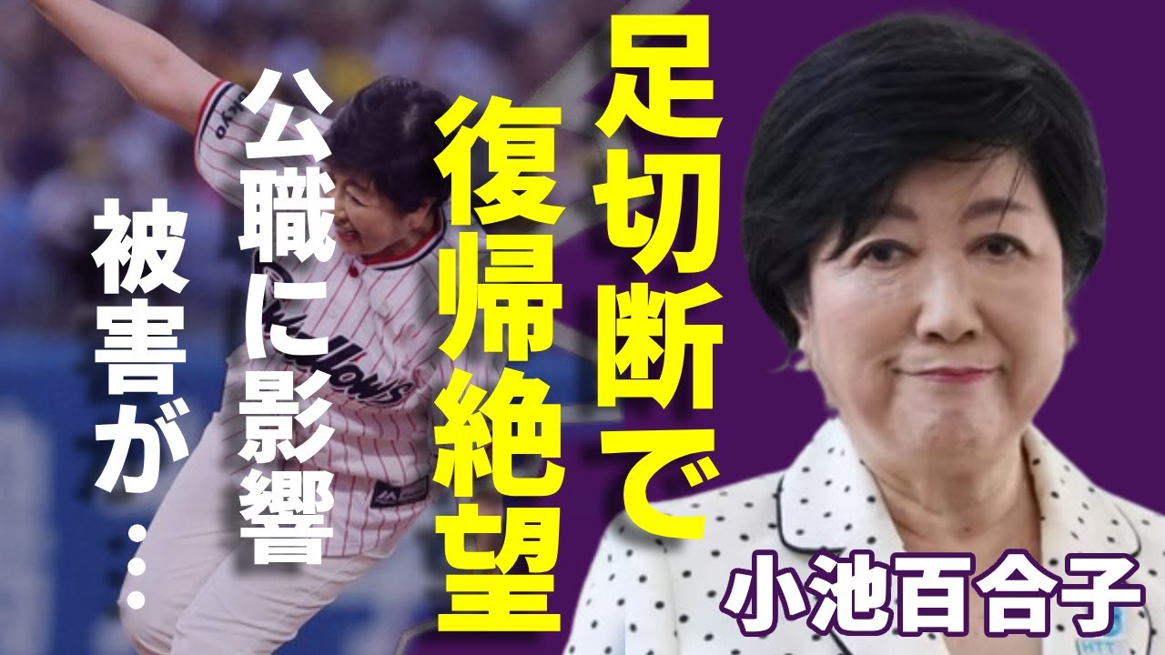 小池百合子が足切断で車椅子生活の現在...業務復帰が絶望的と言われる真相に一同驚愕...！東京都知事選に再選した小池が公職に影響・被害酷すぎる怪我を負った実態に言葉を失う...