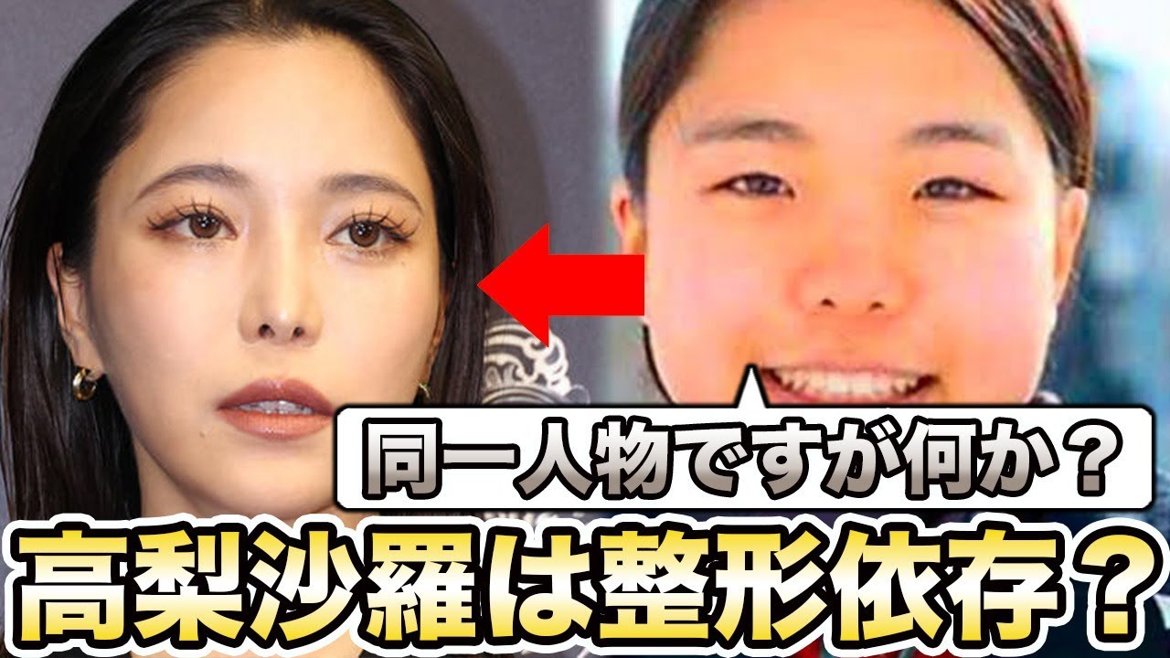 高梨沙羅の整形に対し専門医らが暴露！オリンピック出場選手のヤバすぎるファッションにドン引きの声…登場した担当医師の存在が…