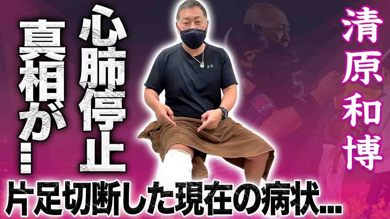 【驚愕】清原和博が泡吐いて心肺停止し緊急搬送された真相…片足切断を余儀なくされた病状に言葉を失う…！『番長』で愛された元野球選手が元妻に絶縁された子供達の現在に驚きを隠せない…！