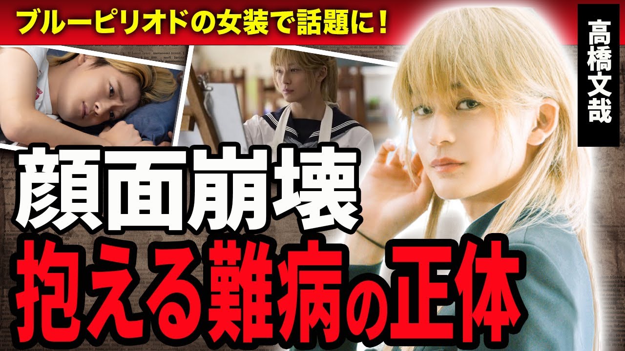 【衝撃】高橋文哉が顔面崩壊する現在がやばい…!激痩せした理由や隠し続けた難病の正体に驚きは隠せない…!『ブルーピリオド』で美しすぎる女装姿を披露した今話題の俳優の永野芽郁との蜜月関係に絶句!