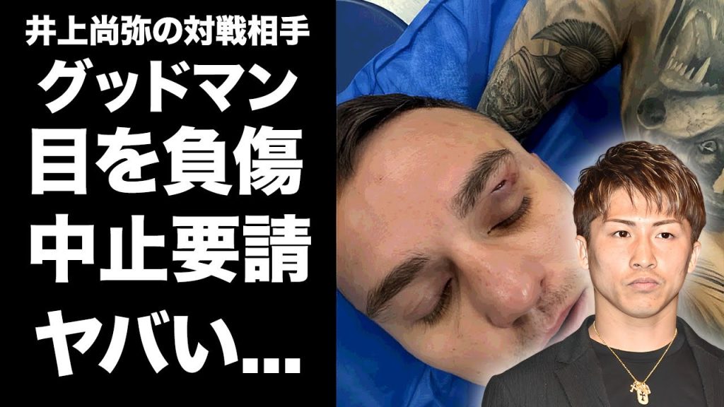 【驚愕】井上尚弥の対戦相手・グッドマンが目の負傷で試合中止要請した真相に驚きを隠せない...『モンスター』との世紀の一戦の中止にCEOボブアラムが出した異例の声明内容に言葉を失う...