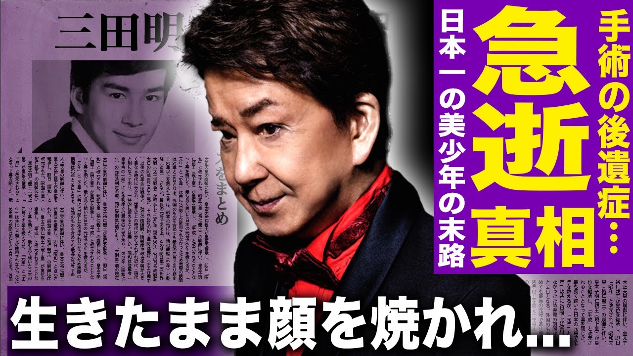 【驚愕】三田明の急死の理由が判明！ハイジャック事件に巻き込まれ生きたまま顔を焼かれた…日本一の美少年と呼ばれた歌手の顔面崩壊した悲惨な末路…マネージャーが多額の借金を作り失踪し事務所倒産した真相…