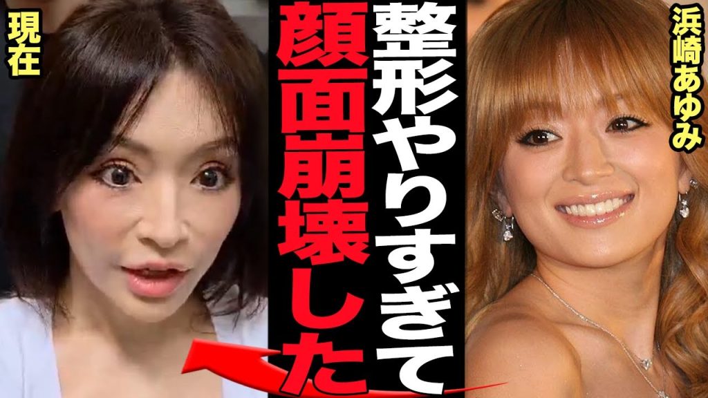 浜崎あゆみが多重整形で顔面崩壊…全盛期から整形し続けないといけない心になってしまった真相に絶句【芸能】