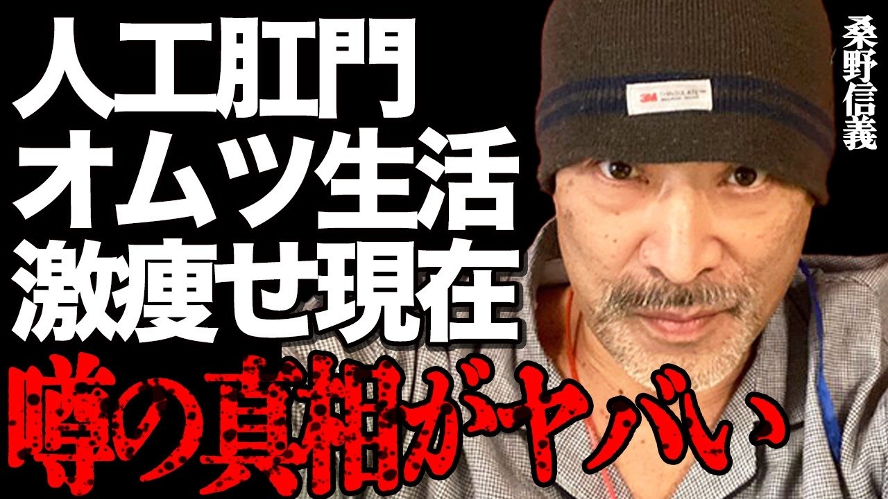 "くわまん"こと桑野信義が排泄障害で糞尿まみれの現在がヤバい…「痔で死ぬのか…」血便を3年間放置した悲惨な末路に言葉を失う…1日60回トイレに行く地獄の日々で激痩せした悲痛な姿に涙が溢れて止まらない…