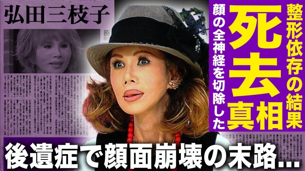 【驚愕】昭和歌姫・弘田三枝子が整形依存で顔面崩壊…美への執着が止まらず後遺症に苦しんだ末路に驚愕！米国不倫愛の逃避行で隠し子まで誕生…芸能界から干され孤独の中で難病・急死の真相に言葉を失う！