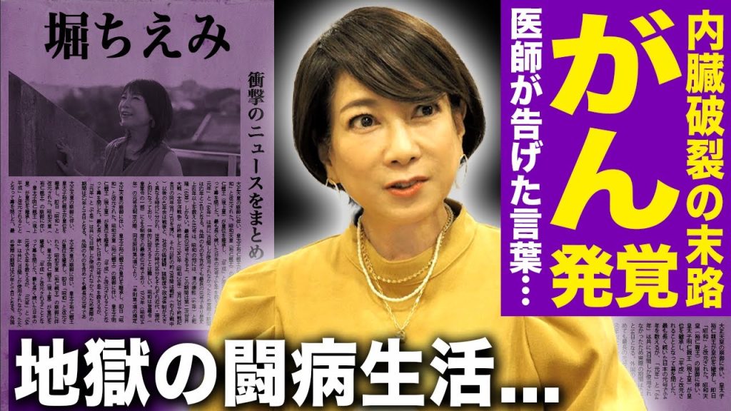 【驚愕】堀ちえみにがん発覚…背中切開の大手術・内臓破裂の末路に言葉を失う！医師が告げた最悪の言葉…激痛で動けず痛み止めも効かない地獄のリハビリ生活の裏側に言葉を失う！